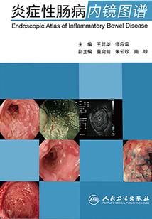 死亡复仇计划